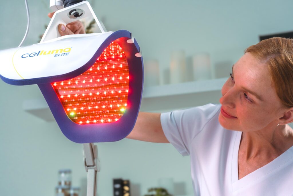Macro visualization of scalp and hair follicles with red light concept representing low-level light therapy.